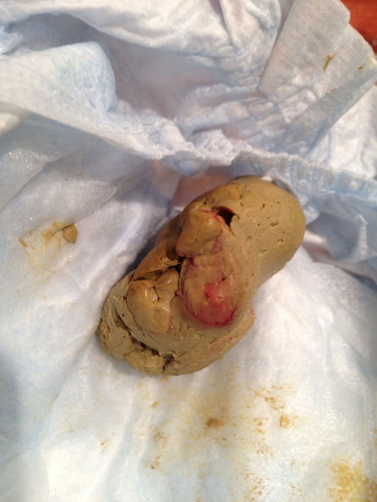 update-blood-in-poop-warning-tmi-nasty-diaper-pic-babycenter