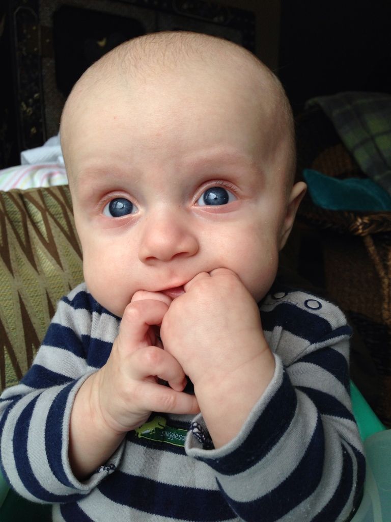 Bald babies!!! *pics* BabyCenter